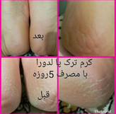 کرم چندمنظوره ترک پا لدورا ۱۰۰ میل