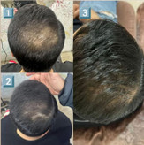 تونیک گیاهی تقویت کننده و ضدریزش موی سر لدورا