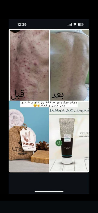 شامپو بدن گیاهی لدورا